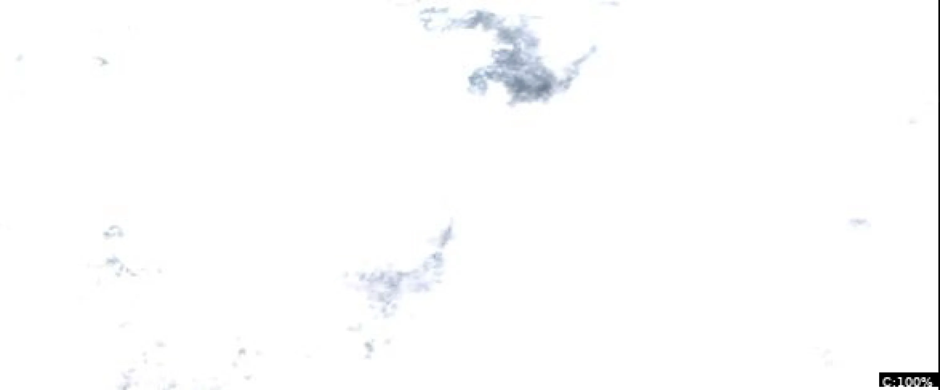 Farm Lake