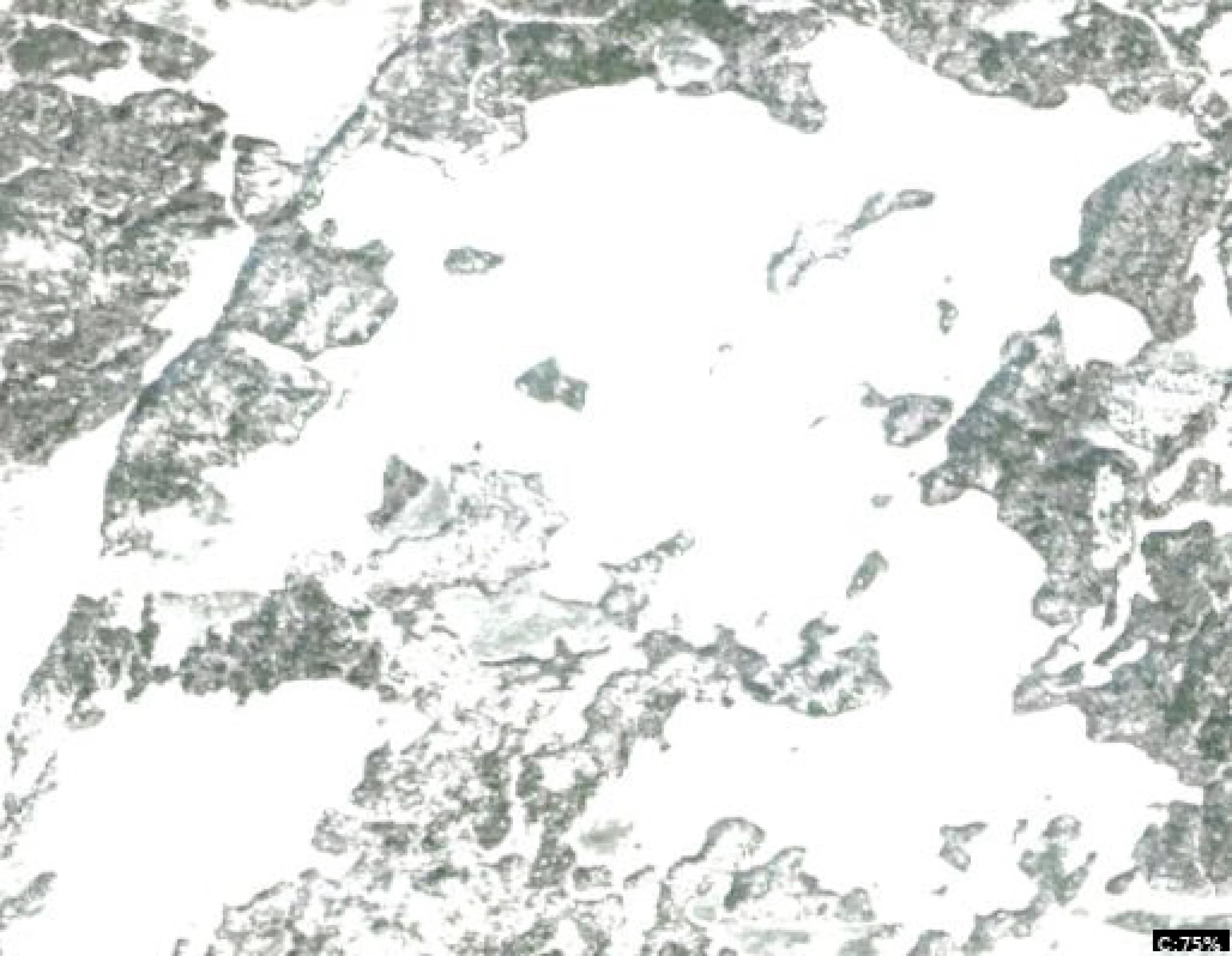 Big Lake